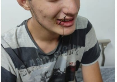 Bu kez oltaya çocuk takıldı