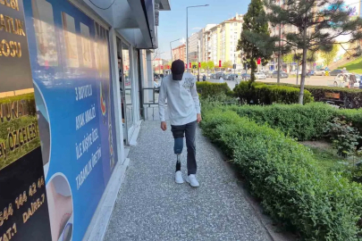 Bacağını kaybeden 15 yaşındaki çocuk, hayırseverler sayesinde özgürlüğüne kavuştu
