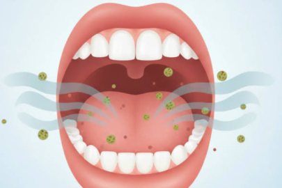AĞIZ KOKUSU İÇİN UZMANINDAN ÖNERİLER....